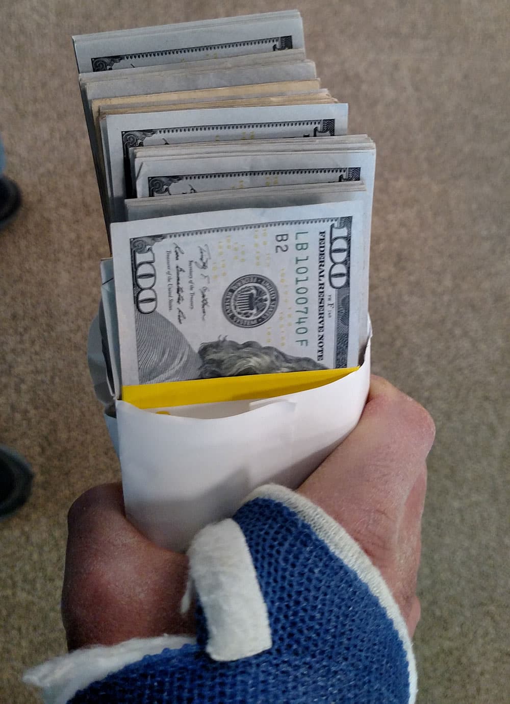 real-money-broken-arm